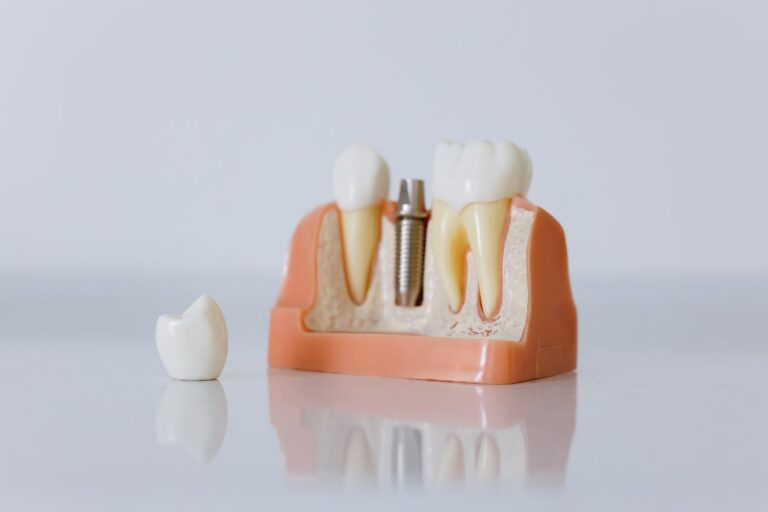 close up shot of dental implant model